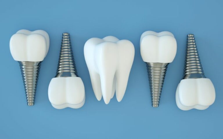 Dental implants laying next to each other