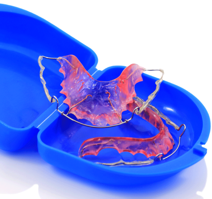 two retainers on top of each other in a blue retainer case